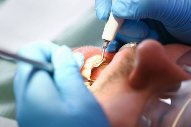 Best Emergency Treatment for Toothache in Clovis, CA